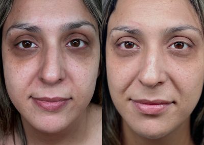 explotación compartida aparatología estética